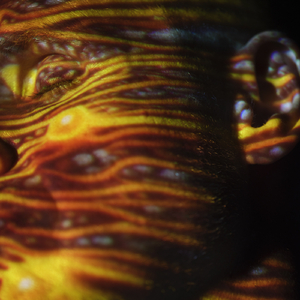 藤原辽子初菊门注入
